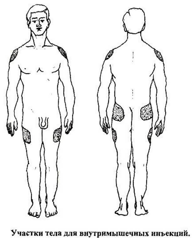 Участки тела для внутримышечных инъекций