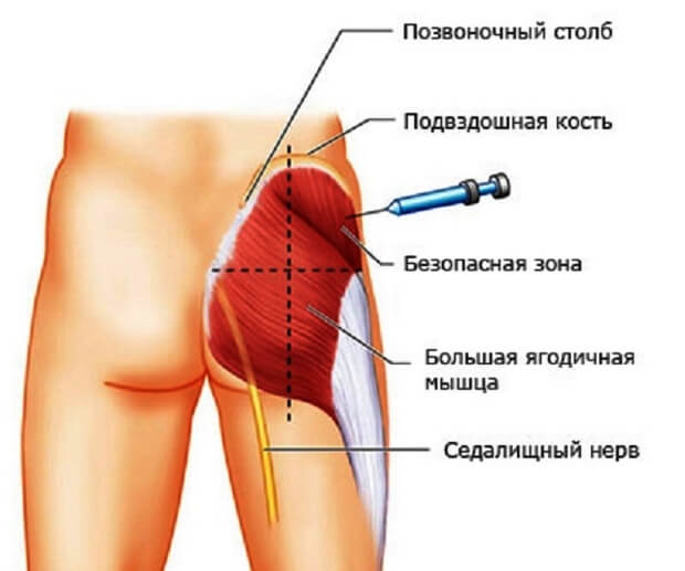 Места для укола