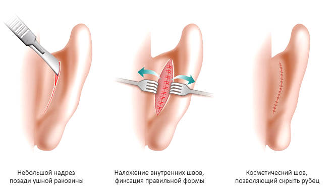 Оперативное вмешательство