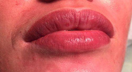 как ухаживать за губами после татуажа