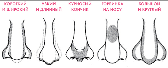 Формы носа и их коррекция