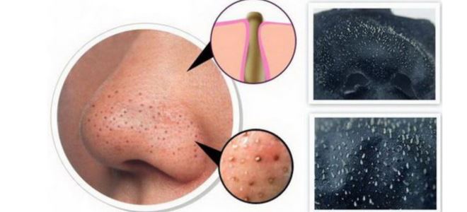 маска вытягивающая черные точки в домашних условиях