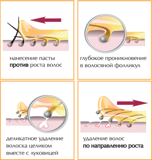 Схема шугаринга