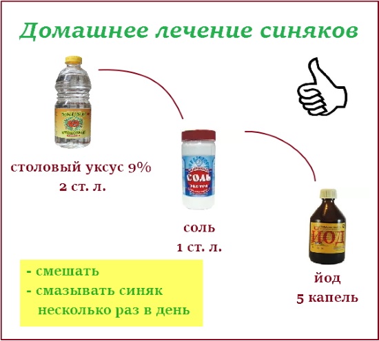 Как быстро избавиться от синяка под глазом. Аптечные, народные средства от гематом на лице, мази