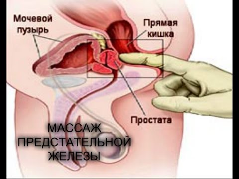 Массаж простаты самостоятельно дома Как самому сделать массаж простаты Стимуля