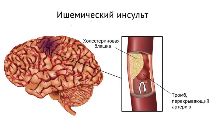 показания к применению