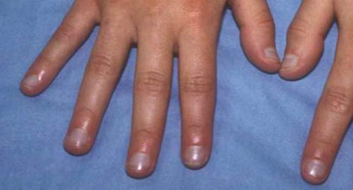 О чем говорит цвет ногтей на руках. Анатомия ногтя