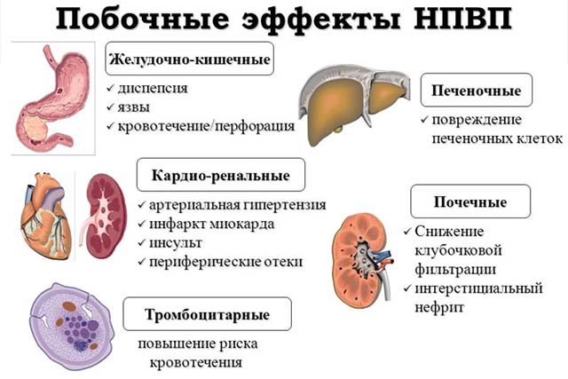 Побочные эффекты НПВС