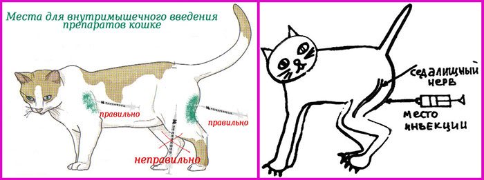 Осторожно, седалищный нерв!