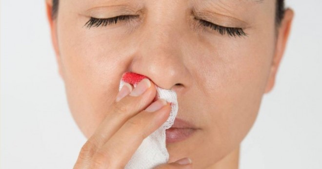 Кровь из носа – 8 причин носового кровотечения и первая помощь
