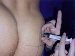 Куда делать укол в ягодицу