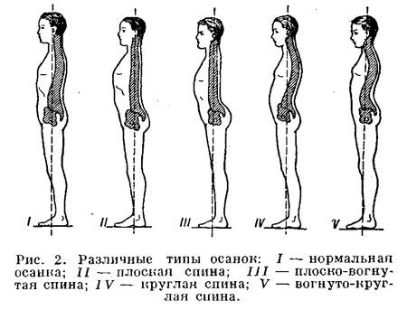 Исправление осанки у взрослых - коррекция упражнениями